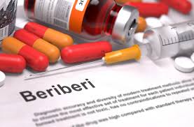 Modern and Traditional Therapies for Beriberi Disease